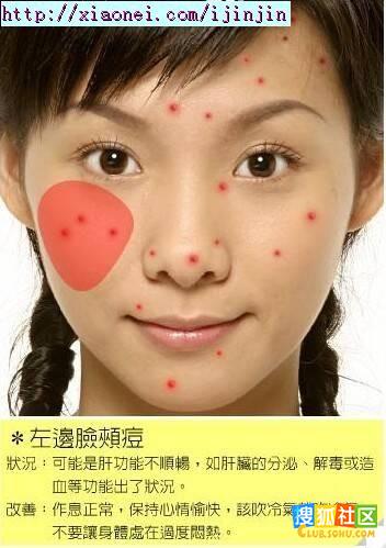 http://image.club.sohu.com/pic/8b/5b/beijing6480ca0d91bb760c.jpg